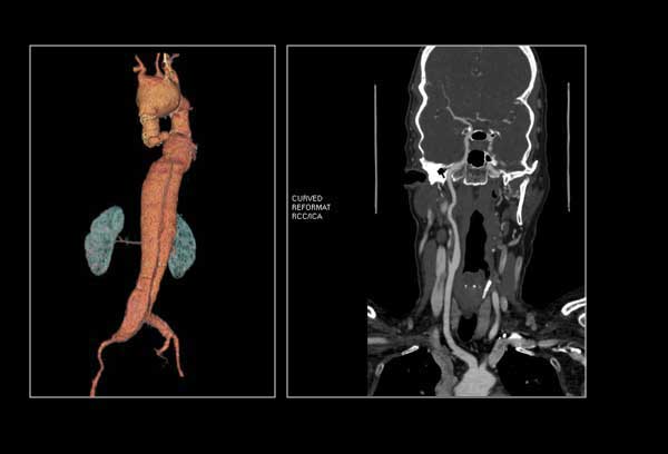 Vascular Imaging)