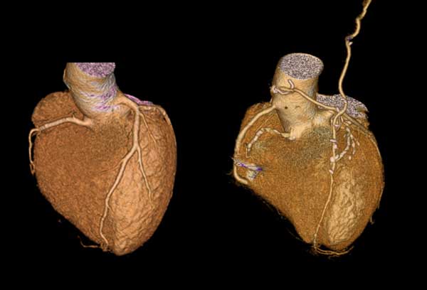 Neurovascular CTA/MRA)
